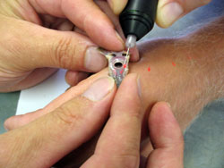 Visible Implant Elastomer (VIE) injection beneath skin